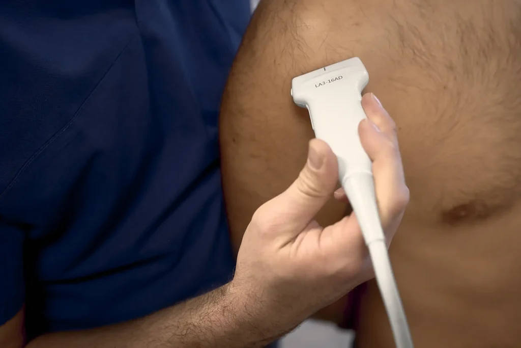 Terapia sulla spalla con deposito di calcio nel tendine della cuffia dei rotatori