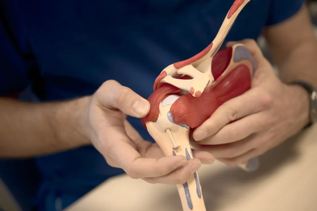 Illustrazione anatomica della cuffia dei rotatori con i quattro tendini della spalla